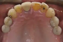 After treatment: Fully comprehensive orthodontics