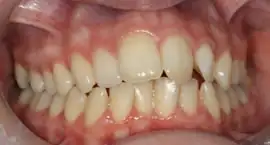 Before treatment: Treatment