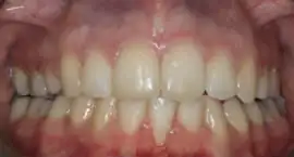 After treatment: Treatment