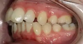 Before treatment: Treatment