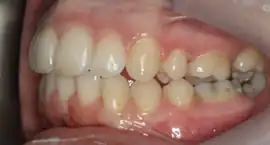 After treatment: Treatment