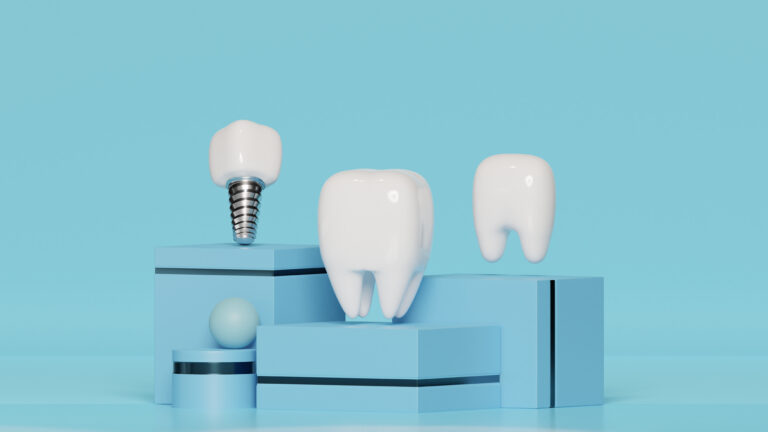 Are Dental Implants Painful? Here’s What to Expect