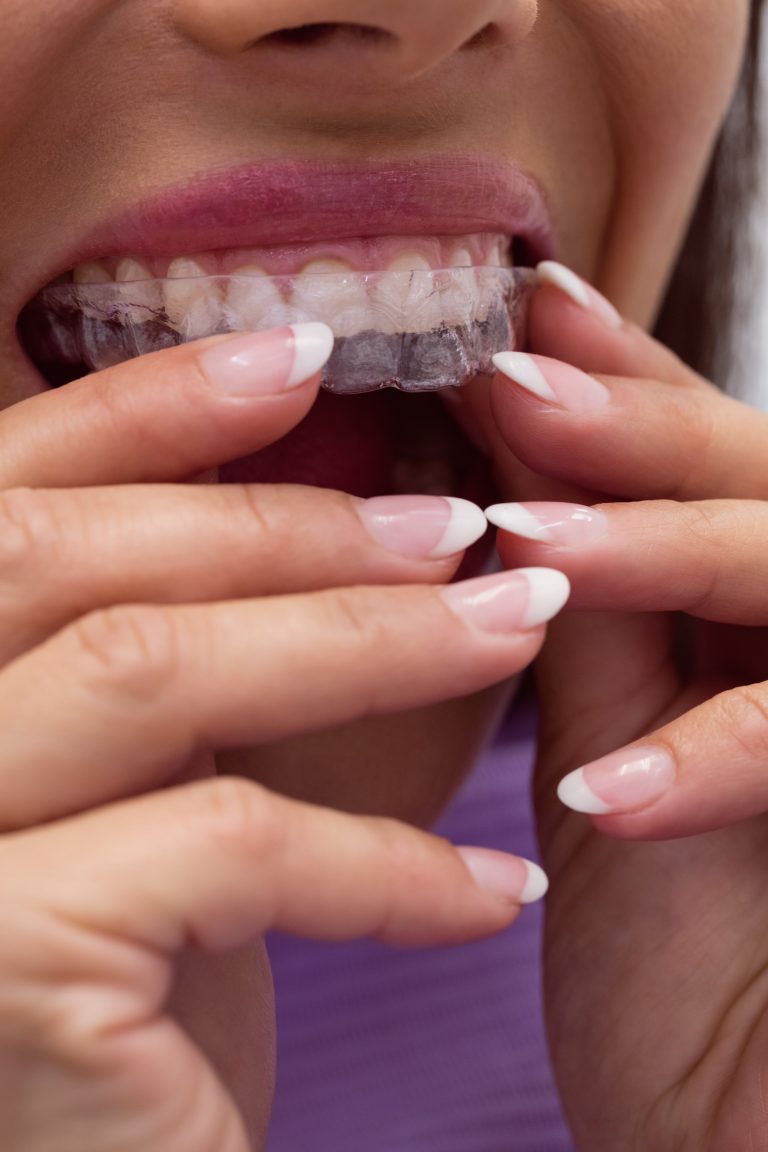 Is Invisalign more painful than braces?